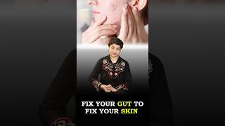 The Link Between Digestive Health amp Clear Skin Connection Between Acne Gut Health amp Skin Problems [upl. by Alurta]