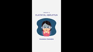 Placenta Abruption [upl. by Retnyw900]