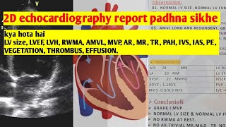 2D echocardiography ki report padhna sikhe [upl. by Gnen]