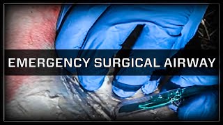 Emergency Surgical Airway  Cricothyroidotomy [upl. by Aryad]