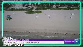 Sea lice stirs up on Florida beaches as Hurricane Lee passes by [upl. by Nylicaj]