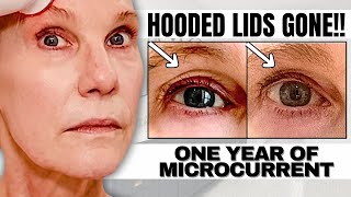 I Tried MICROCURRENT For A YEAR On My Mature Over 50 Skin Surprising Unexpected Results [upl. by Atirabrab]