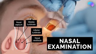 Nasal Examination  Nose Examination  OSCE Guide  UKMLA  CPSA [upl. by Spanjian872]