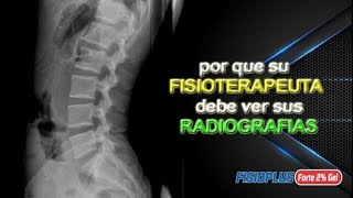 POR QUE SU FISIOTERAPEUTA DEBE VER SUS RADIOGRAFÍAS [upl. by Daniele109]