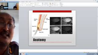 Management Hordeolum ampKhalazion [upl. by Roch]