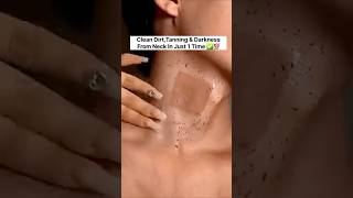 Neck Cleaning Tips  Dark Neck Home Remedies Tanning Removal Tips😲 beautyskincare rshortsviral [upl. by Iahcedrom360]