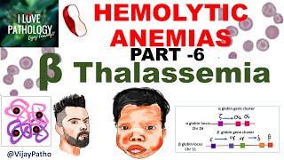 Hemolytic Anemias Part 6 Beta Thalassemia Pathogenesis types Diagnosis amp Treatment [upl. by Tasia]