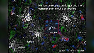 Progenitor CellBased Modeling and Treatment of Glial Disease [upl. by Idnic]