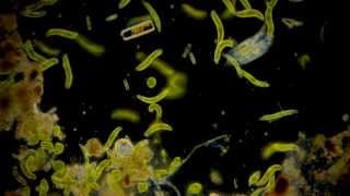 🔬 opisthotricha  microorganisms under microscope  microcosmos dark field microscopy HD [upl. by Younglove]