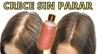 ¡NO LO USES MUCHO NACE CABELLO HASTA DONDE NO TIENES😱 Y DEJA DE CAER 😍REMEDIO POTENTE [upl. by Creath]