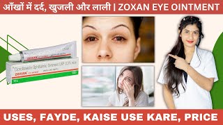 Zoxan Eye Ointment Uses  Ciprofloxacin Ophthalmic Ointment Usp 03 Ww Zoxan Eye Ointment  Price [upl. by Dualc487]