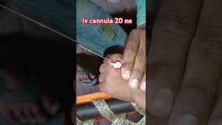 iv cannulation procedure trending  short video doctorsadvice13 [upl. by Derina]