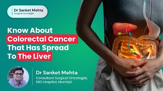 Know About Colorectal Cancer That Has Spread to the Liver  Colorectal Liver Metastasis  Dr Sanket [upl. by Anirehtac]