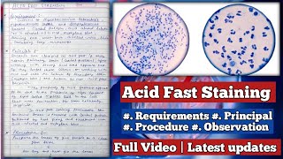 Acid Fast Staining  Requirements Principal Procedure Observation amp Results of Staining [upl. by Enaek]