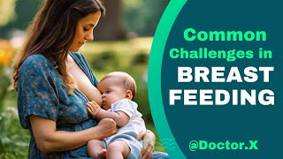 Common Challenges in Breastfeeding Overcoming Hurdles for New Moms [upl. by Daraj184]