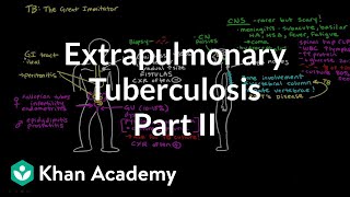 Treatment of Active TB  Infectious diseases  NCLEXRN  Khan Academy [upl. by Eanad]