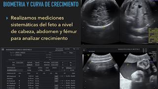 Ecografía obstétrica  Ideal para estudiantes [upl. by Letsyrc]