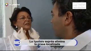 Lipólisis exprés Eliminación de la grasa localizada con Aqualyx cirugiaplastica [upl. by Delp]