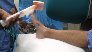 Presurgical foot preparation MWMC Podiatry [upl. by Ihtac]