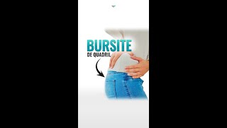 4 exercícios para bursite no quadril 🔥🔥🔥 [upl. by Ayalahs]