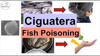 Ciguatera Fish Poisoning Ciguatoxin  Symptoms Numb Feet Diarrhea Diagnosis Treatment [upl. by Foscalina]