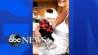 Chrissy Teigen responds to backlash over photo of her baby in a helmet [upl. by Signe]