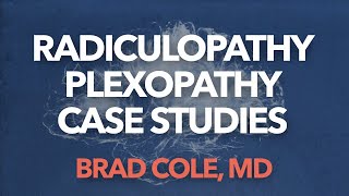 Radiculopathy Plexopathy case studies 1 [upl. by Rednasyl700]