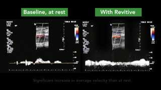 How REVITIVE increases circulation [upl. by Alys]