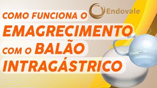 Como funciona o EMAGRECIMENTO com o BALÃO INTRAGÁSTRICO [upl. by Court277]