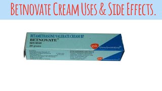 Betnovate Cream for Skin Problems – Everything You Need to Knowquot [upl. by Danny386]