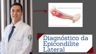 Epicondilite Lateral e Medial do Cotovelo BANDAGEM McConnell  Clínica Fisioterapia Dr Robson Sitta [upl. by Baxie]