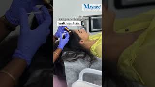 GFC Treatment  Hair loss Treatment  Maynee Cosmetology Clinic [upl. by Anilrats]