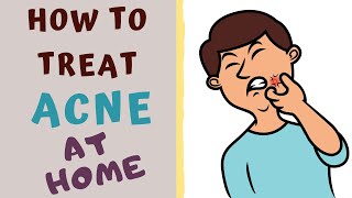 HOW TO TREAT ACNE AT HOME Acne All you need to know [upl. by Richmond]