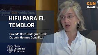 HIFU tratamiento sin cirugía del temblor esencial y Parkinson Clínica Universidad de Navarra [upl. by Jovita]