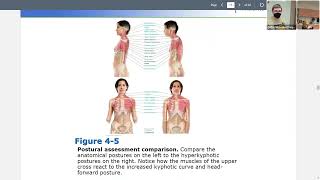 Hyperkyphosis Introduction for Massage Therapists [upl. by Grodin]