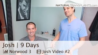 Hair Transplant Suture Removal  FUT vs FUE Scar Truth  West Palm Beach FL Josh [upl. by Tearle904]