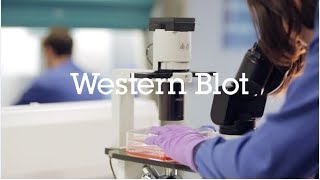 Western blot protocol video [upl. by Aitekram]