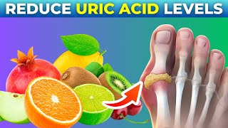 10 Foods That Reduce Your Uric Acid Levels [upl. by Daye422]