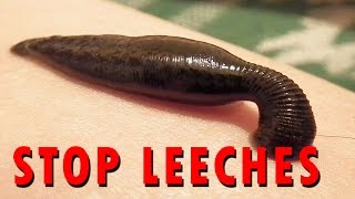 How to stop Leeches [upl. by Gascony]