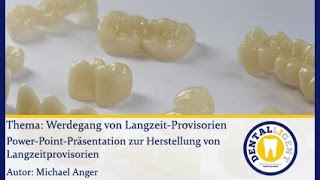 ZahntechnikGRATISWerdegang von Langzeitprovisorien [upl. by Murat]