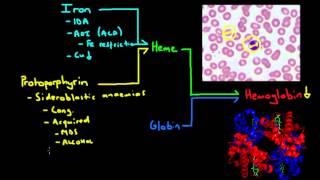 Microcytic Anemia  The Major Causes [upl. by Anillehs]