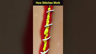 How wound stitches really work shorts facts  Creativelearning3d [upl. by Treborsemaj]