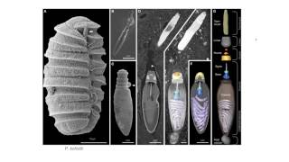 Dinoflagellates  Nematocysts [upl. by Quarta]