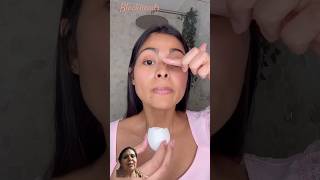 Removed blackheads with egg shorts trending viral ytshots beauty beautips skincare [upl. by Zadoc]