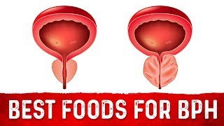 Best Foods For Benign Prostatic Hyperplasia BPH – DrBerg [upl. by Solraced488]