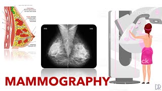 Basic Mammography Techniques [upl. by Mayap]