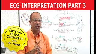 EKG or ECG Interpretation  Part 320 [upl. by Aicac]