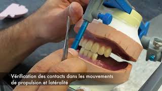 16 LABO montage des dents anterieurs mandibulaires [upl. by Bui]