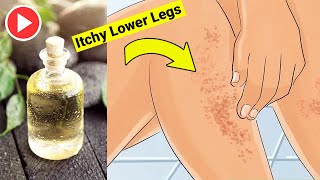 Find Relief From Itchy Lower Legs at Night Discover the Causes and Effective Treatments Today [upl. by Mommy]