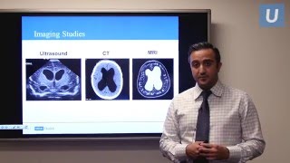 Management of Pediatric Hydrocephalus  Aria Fallah MD  UCLAMDChat [upl. by Heman]